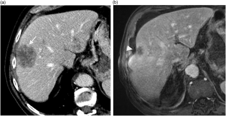 Fig. 7.