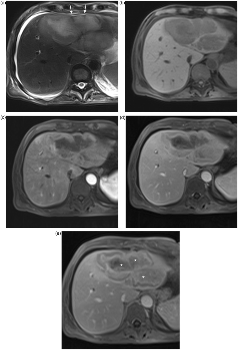 Fig. 13.