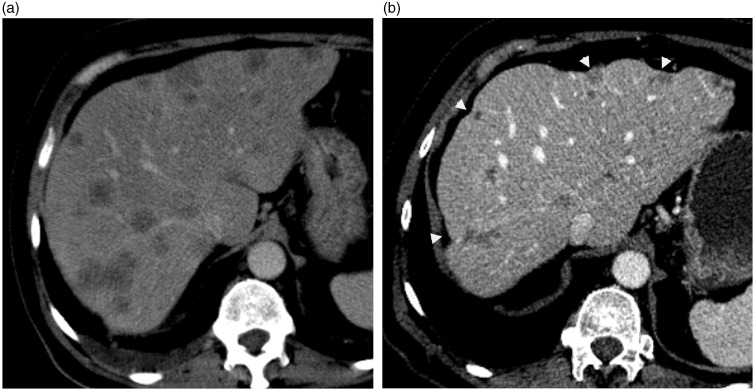 Fig. 10.