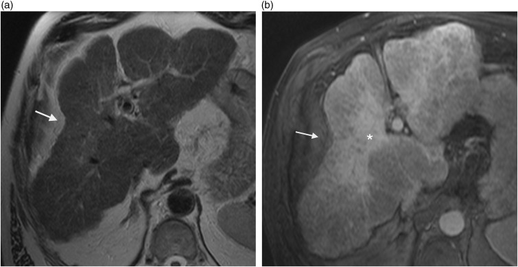 Fig. 11.