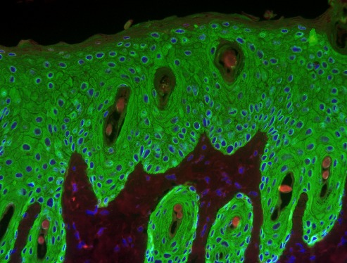 Skin section showing the proliferative response induced by a tumor promoter in the epidermis of a wild-type mouse.