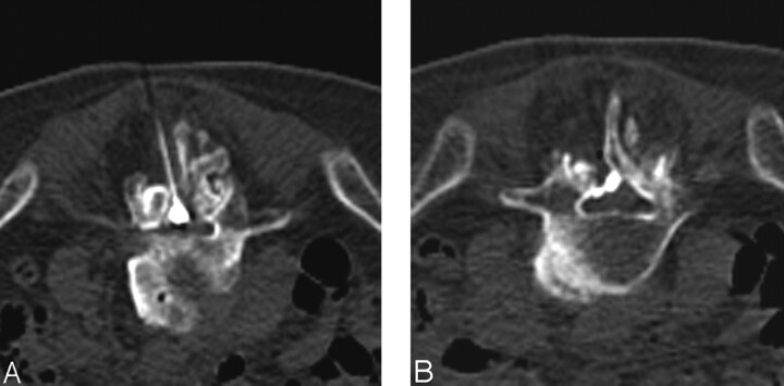 Fig 3.