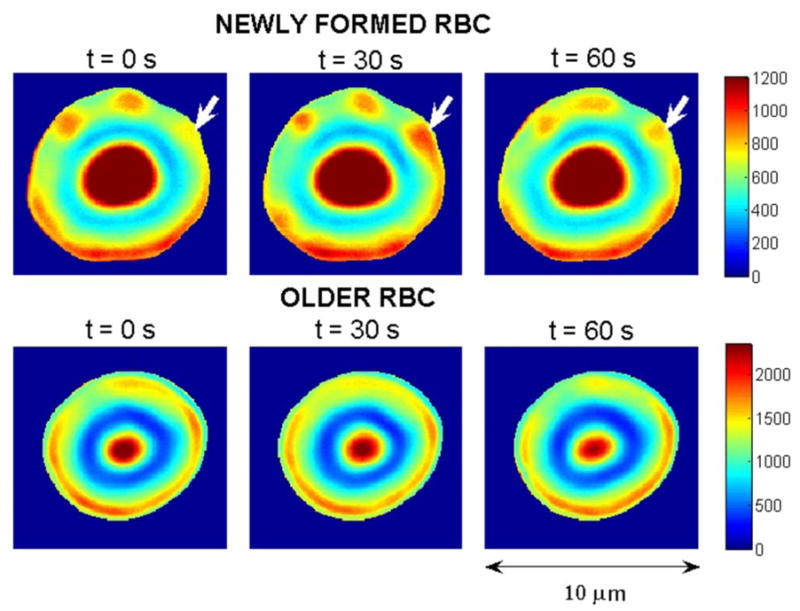 FIG. 1