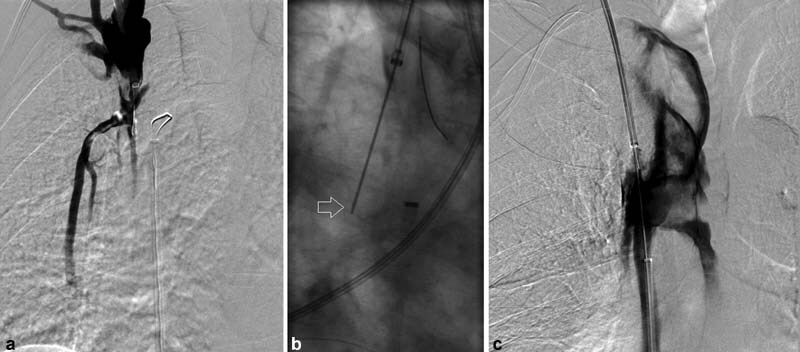 Fig. 12