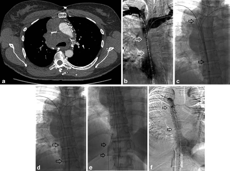 Fig. 8