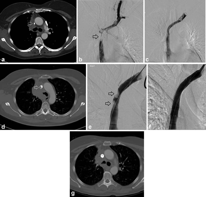 Fig. 11