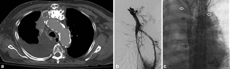 Fig. 13