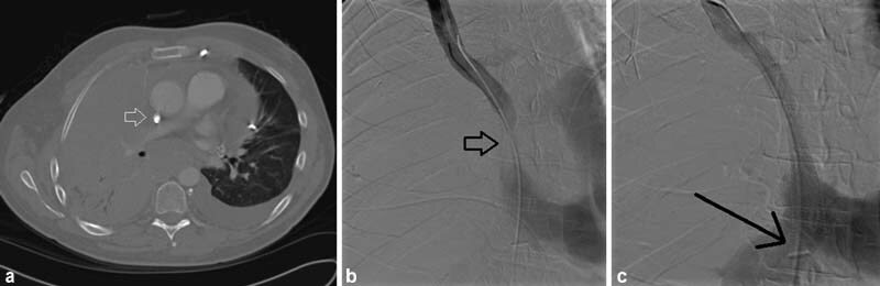 Fig. 9