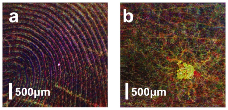 Fig. 9