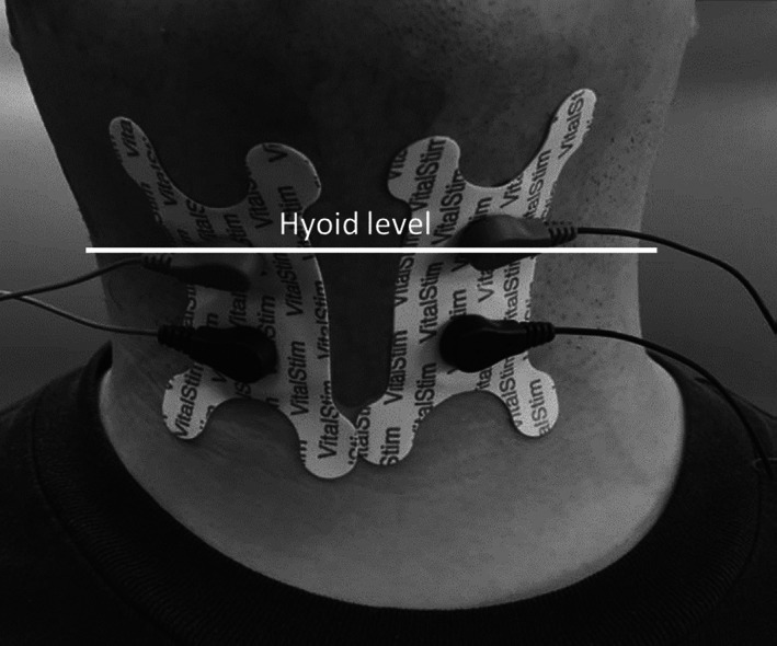 FIGURE 2