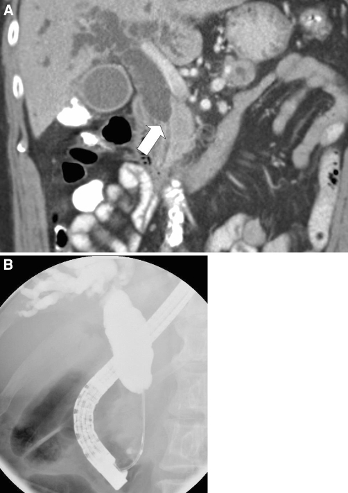 Fig. 1