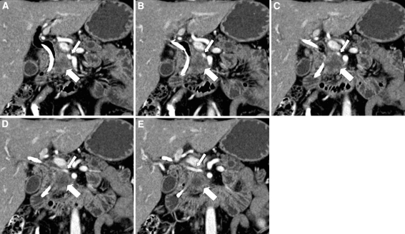 Fig. 4