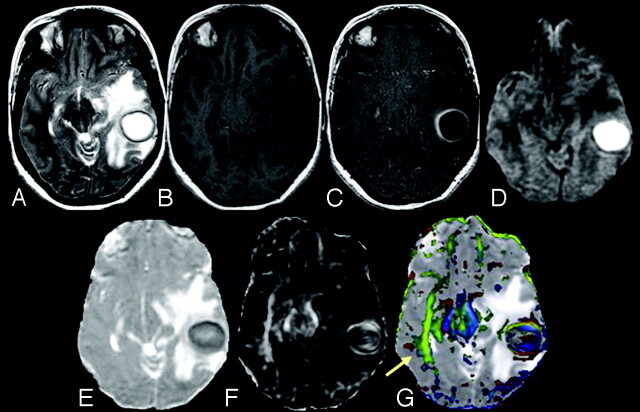 Fig 1.