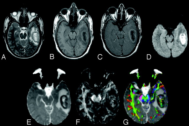 Fig 2.