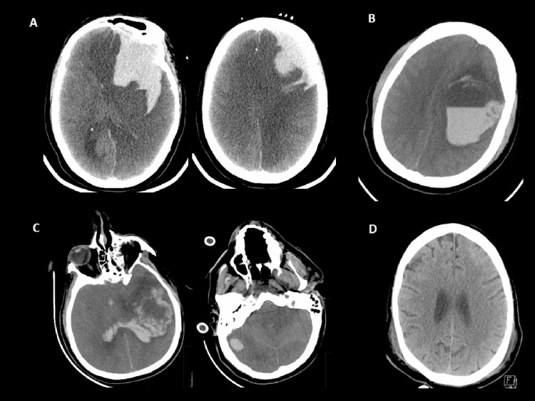 Fig 1