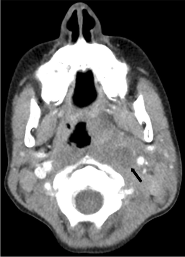 Fig. 8