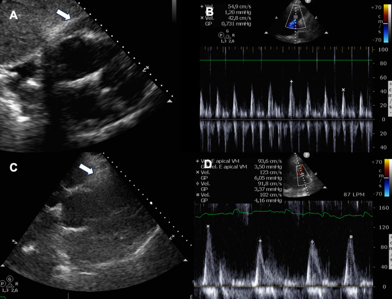 Fig. 1