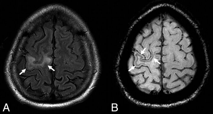 Fig 2.