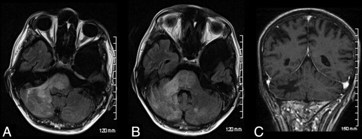 Fig 1.