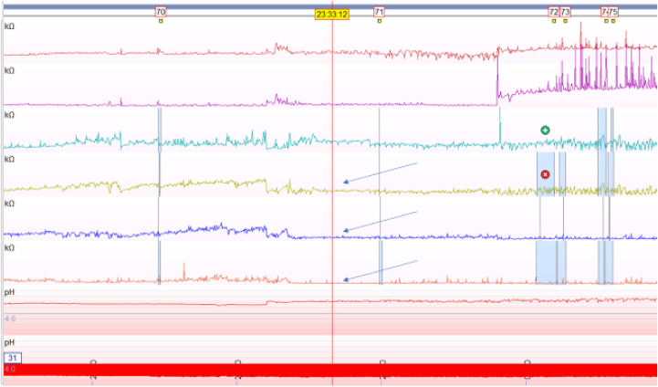 Figure 2