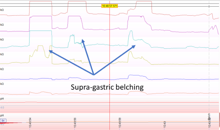 Figure 4