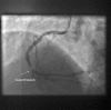 Fig. (2)