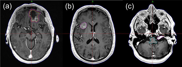 FIGURE 1