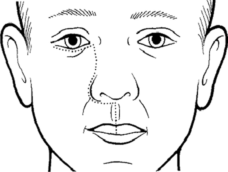 Fig. 3