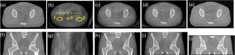 Fig. 10