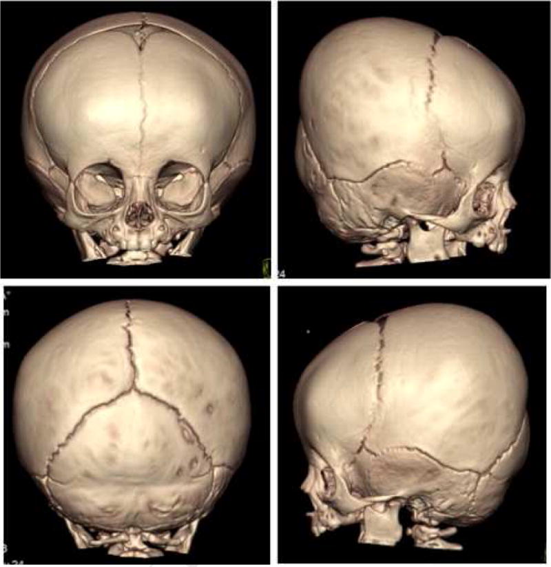 Fig.2