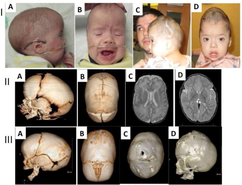 Fig.1