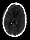 FIG. 1.