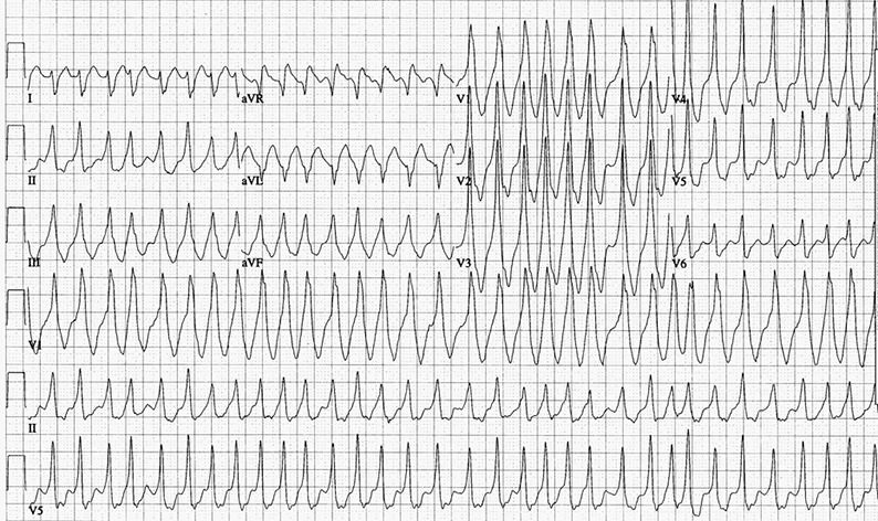 Figure 7: