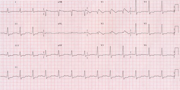 Figure 6: