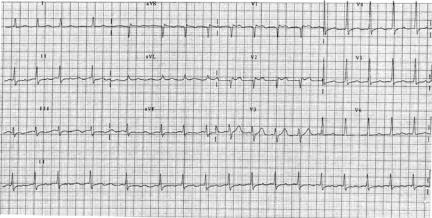 Figure 5: