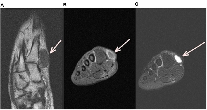 FIGURE 1