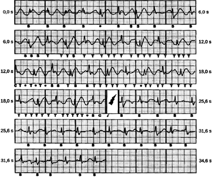 Figure 18.