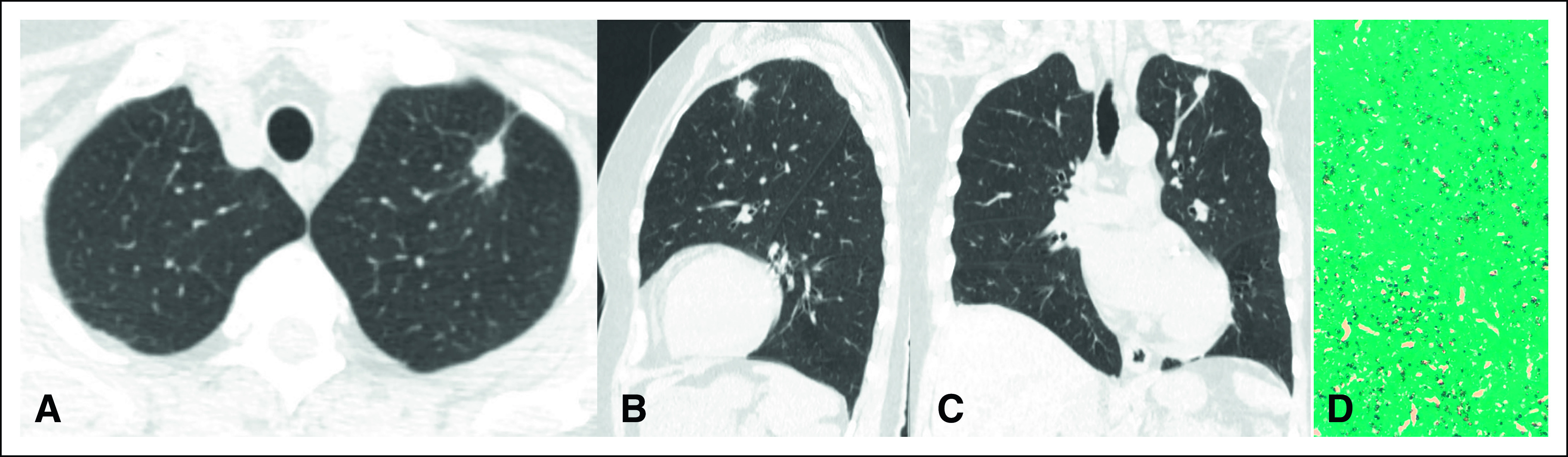 FIG 2