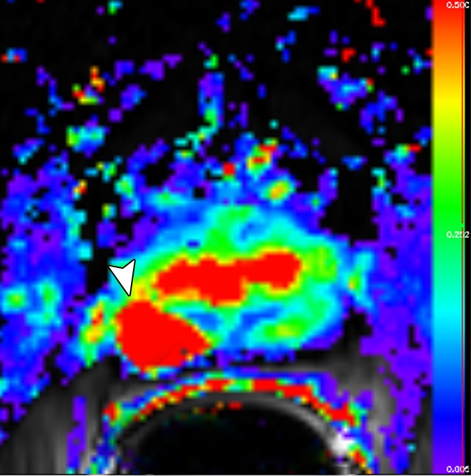 Figure 3b: