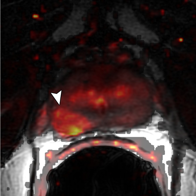 Figure 3d: