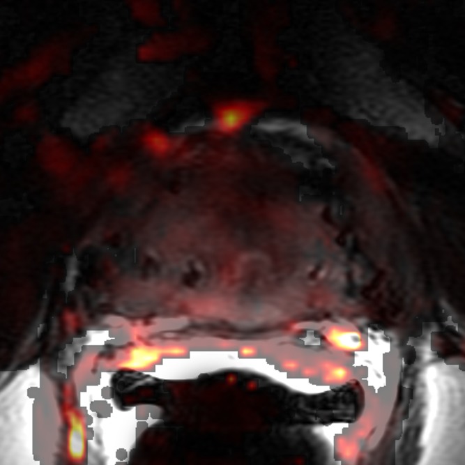 Figure 4d: