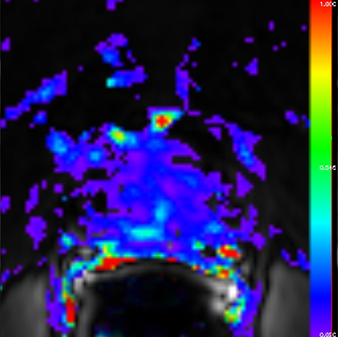 Figure 4b: