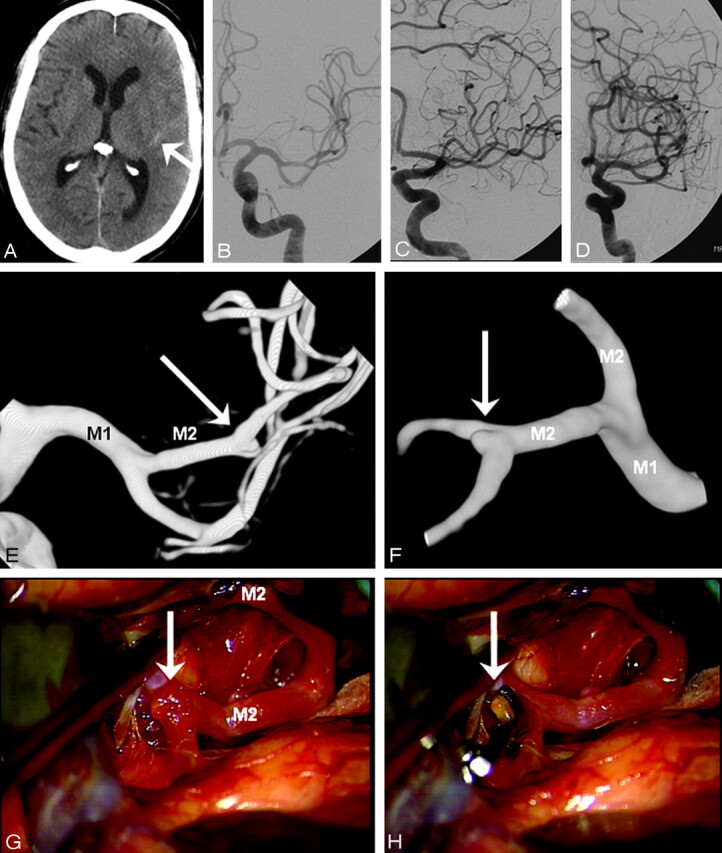 Fig 2.