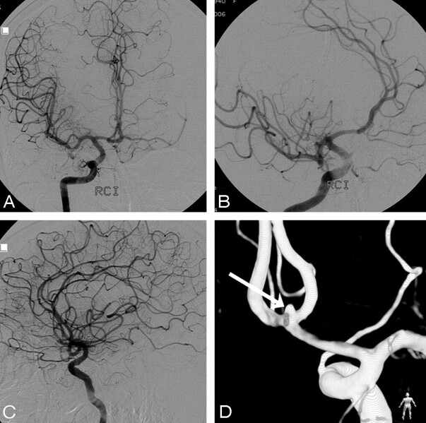 Fig 3.