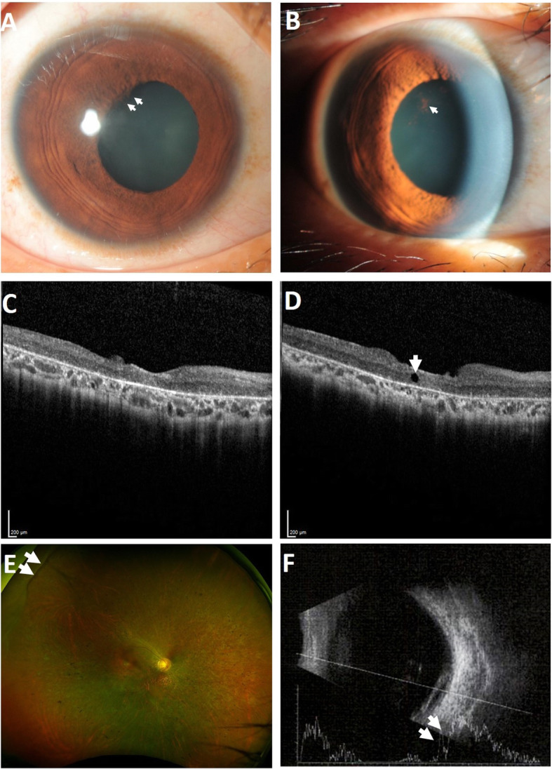 Fig. 6