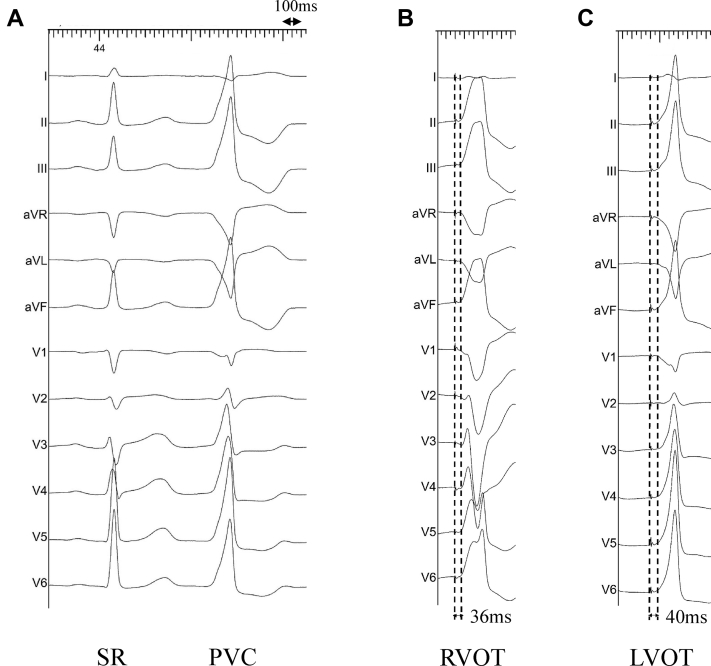 Figure 1