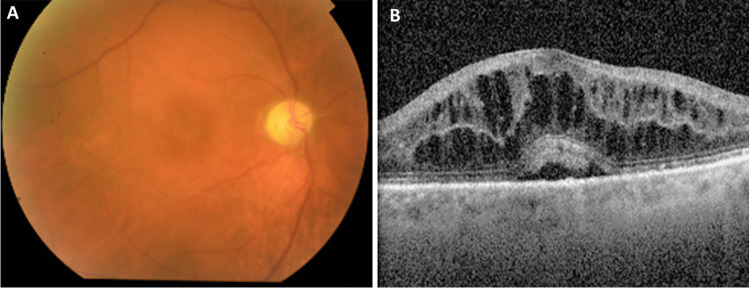 Fig. 1