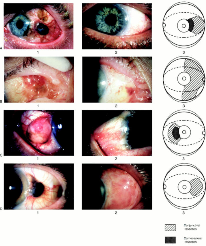 Figure 1  