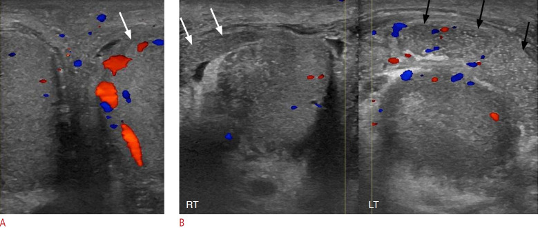 Fig. 14.