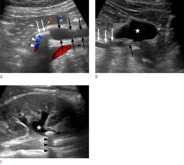 Fig. 15.